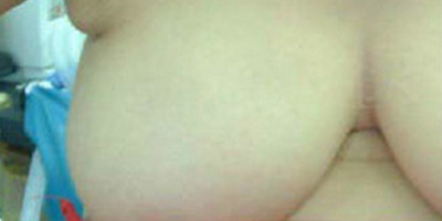 吸脂去副乳术前