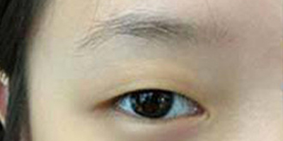 半永久纹眉术前