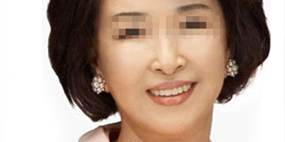 热拉提术后