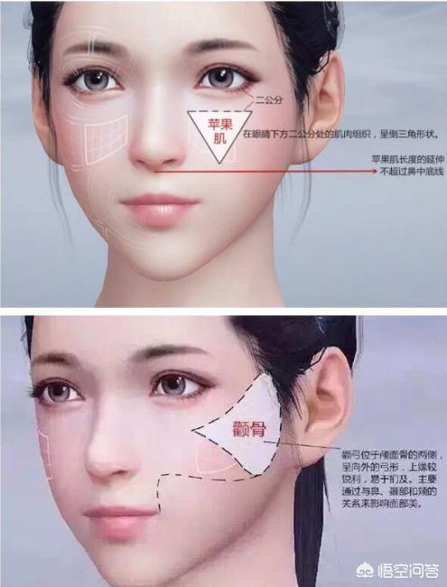 玻尿酸填充苹果肌后效果能保持多久？想丰苹果肌是自体好一点还是玻尿酸好一点？