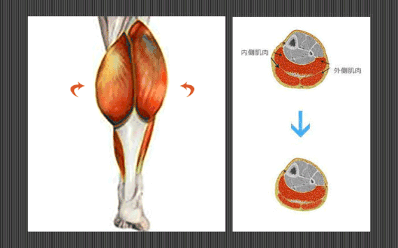 小腿肌肉阻断术是什么？小腿神经阻断术的后遗症有吗？