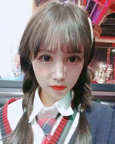 成都美立方（原华博）医疗美容医院张娟眼部修复案例效果分享