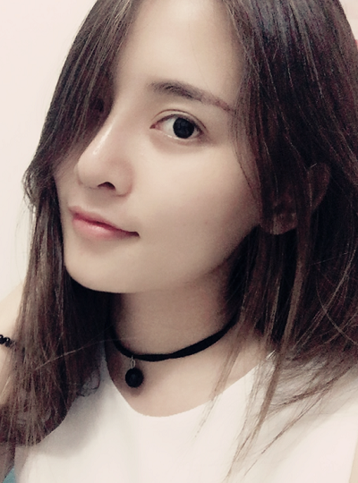 深圳微姿医疗美容门诊部康壮为做鼻综合案例效果分享