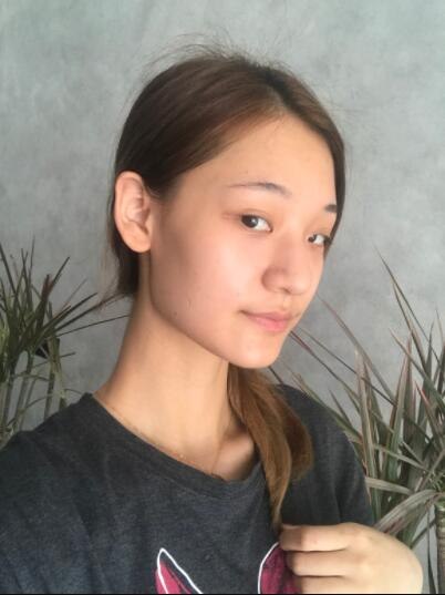  成都蜀尚蓉雅美容整形医院陈秀荣鼻综合案例效果分享