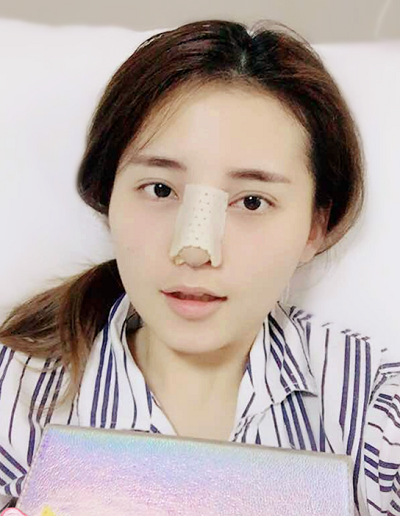 深圳微姿医疗美容门诊部康壮为做鼻综合案例效果分享