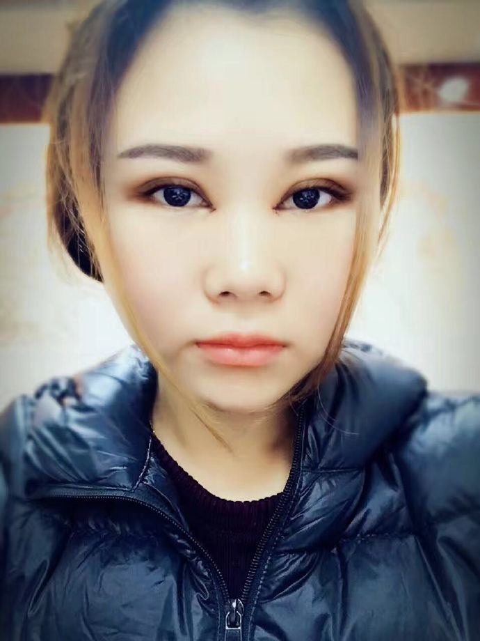 汕头曙光双眼皮一周正面