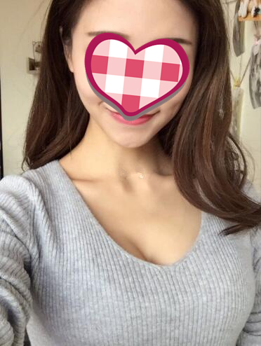 济南美尔雅整形自体脂肪隆胸术后两个月