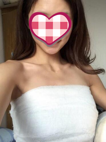 济南美尔雅整形自体脂肪隆胸术后第二天