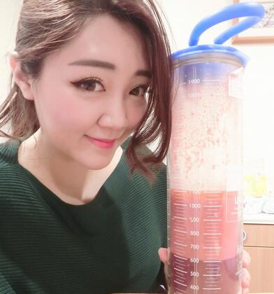 揭阳美莱整形手臂吸脂案例吸脂量