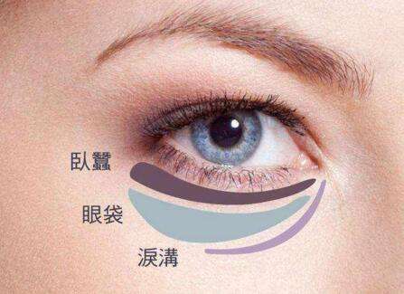眼袋失败修复要怎么处理？切眼袋需要多长时间恢复？