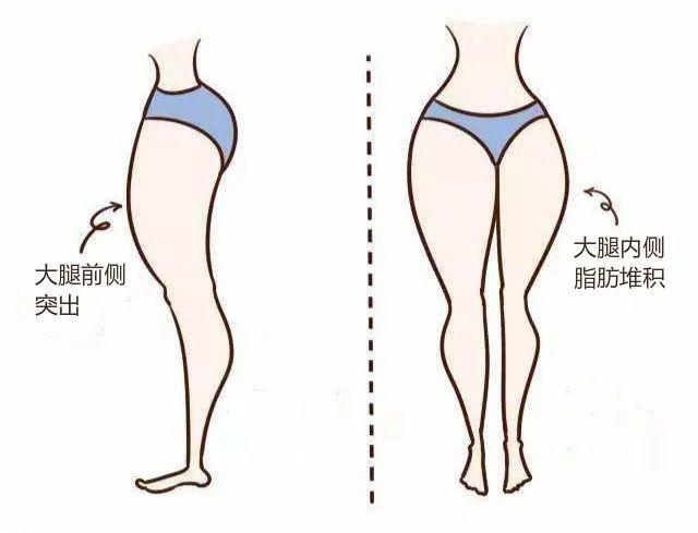 隔空溶脂瘦大腿有什么副作用 隔空溶脂瘦大腿如何护理