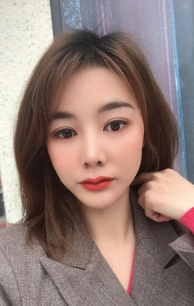厦门华美名媛整形美容医院做双眼皮手术的最终效果