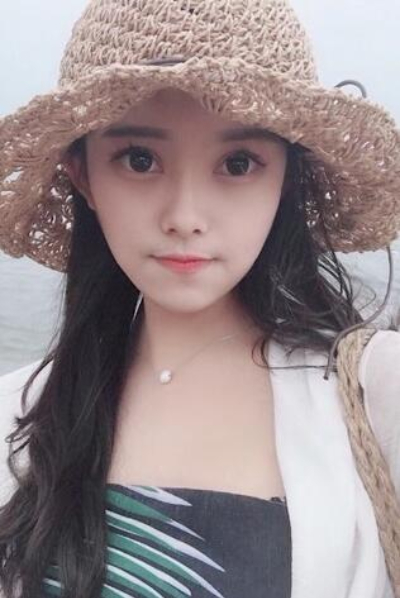 上海新健威医疗美容门诊部做双眼皮手术后三天的情况