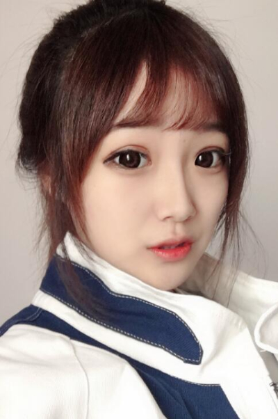 苏州爱思特医疗美容医院做隆鼻手术后的鼻子状态