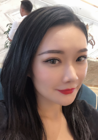  宁波尚美整形美容医院做双眼皮手术后的效果