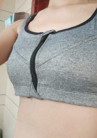 上海美莱医疗美容门诊部做隆胸手术后一个月的情况