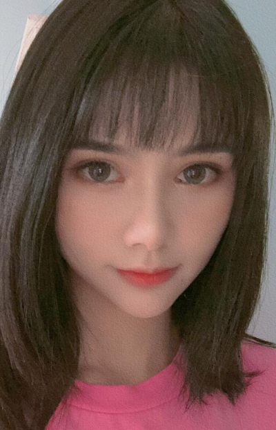 长春亚韩医学美容医院做面部吸脂手术小脸的最终效果