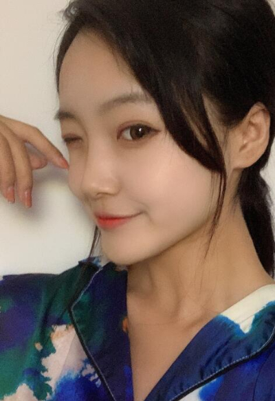 苏州爱思特医疗美容医院做隆鼻手术后的鼻子的日常