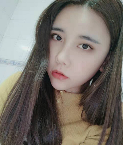 上海艺星医疗美容医院做颧骨降低手术后日常恢复