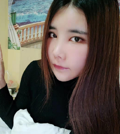 上海艺星医疗美容医院做颧骨降低手术后去拆线情形