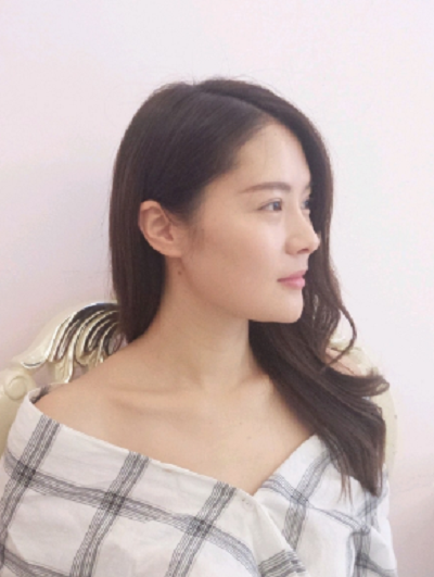  宁波尚美整形美容医院做鼻综合手术后复诊情况
