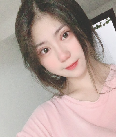 温州友好医院整形美容中心做双眼皮手术10天后