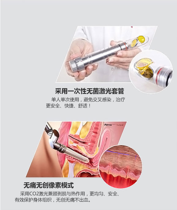 成都爱尔丽整形激光紧缩阴道怎么样？激光紧缩阴道注意什么？