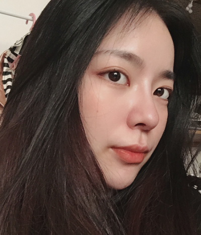 成都汉密尔顿美容医院做鼻修复术后的日常情况
