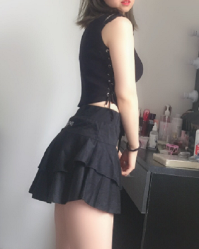 烟台壹美整形美容医院做腰腹吸脂手术后的最终效果