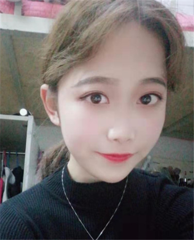 苏州美贝尔美容医院做面部吸脂术后的最终效果