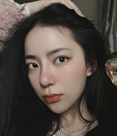成都汉密尔顿美容医院做鼻修手术后的恢复情况