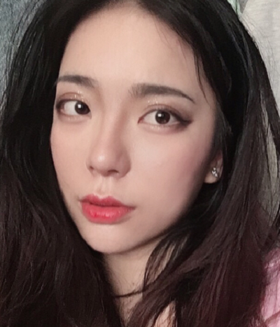 成都汉密尔顿美容医院做鼻修复手术后的最终效果