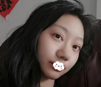在上海伊美尔港华做假体隆鼻术前效果