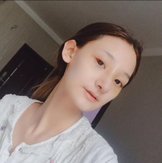 成都蜀尚蓉雅美容整形医院做鼻综合术后的最终效果