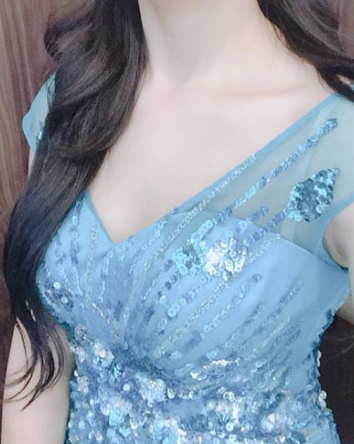 北京艺星医疗美容医院做自体脂肪隆胸手术后的胸部