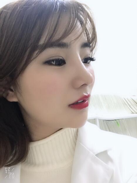 上海美莱医疗美容门诊部做鼻综合术后的最终效果