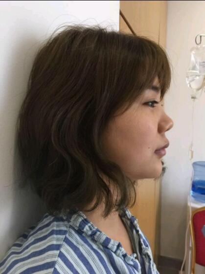 上海美莱医疗美容门诊部做鼻综合手术前