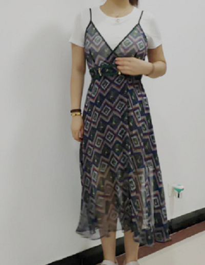 厦门海峡整形美容医院做腰腹吸脂拆完线后