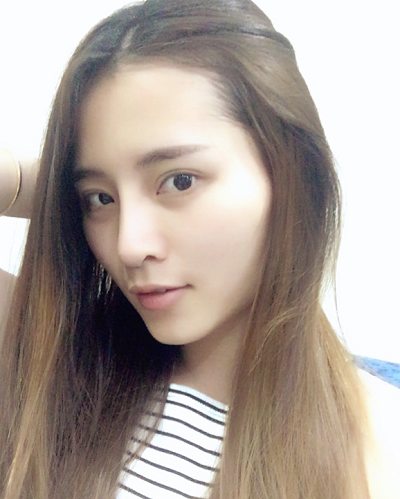 深圳微姿医疗美容门诊部做鼻综合手术后的日常恢复
