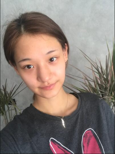 成都蜀尚蓉雅美容整形医院做鼻综合术前的鼻子