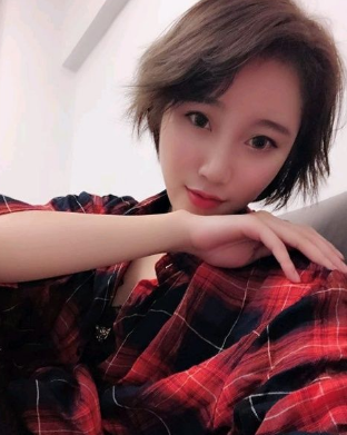 上海时光整形外科医院做鼻综合手术后的第三个月