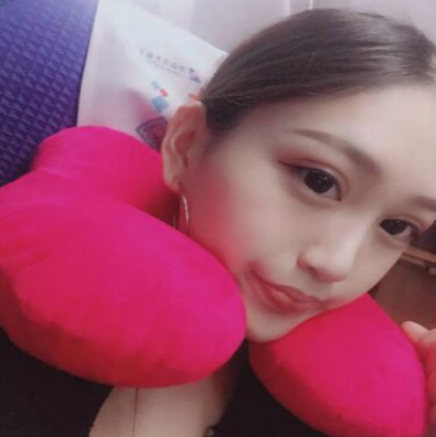 成都美立方（原华博）医疗美容医院做肋软骨隆鼻手术后的最终效果