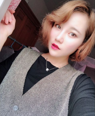 上海时光整形外科医院做鼻综合手术后的第一个月