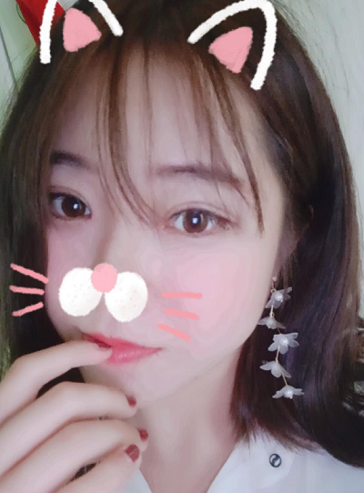 北京东方瑞丽医疗美容门诊部做双眼皮手术后的最终效果
