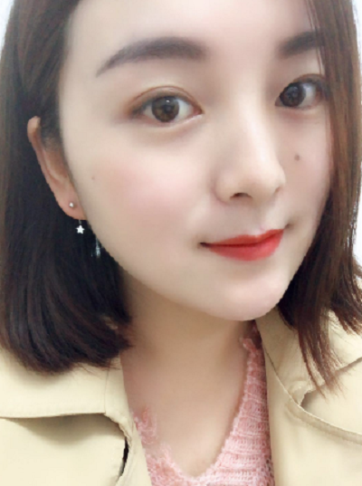 上海东方丽人美容医疗医院做面部吸脂手术后的最终效果
