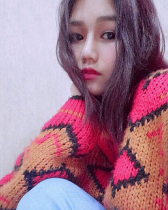 成都蜀尚蓉雅美容整形医院做鼻综合术后的最终效果