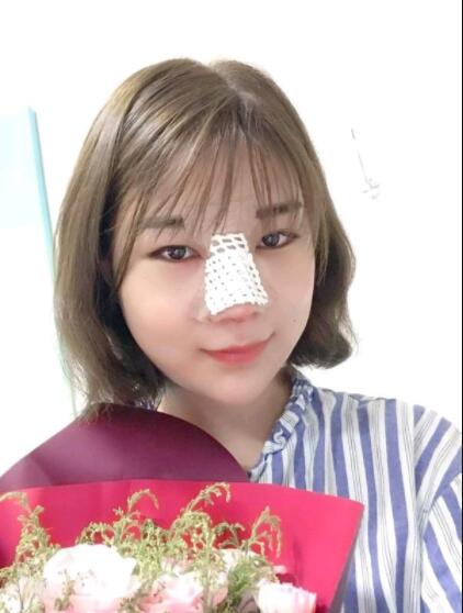 上海美莱医疗美容门诊部做鼻综合刚刚结束手术