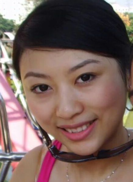 南京美贝尔医疗美容医院做假体隆鼻手术前的样子