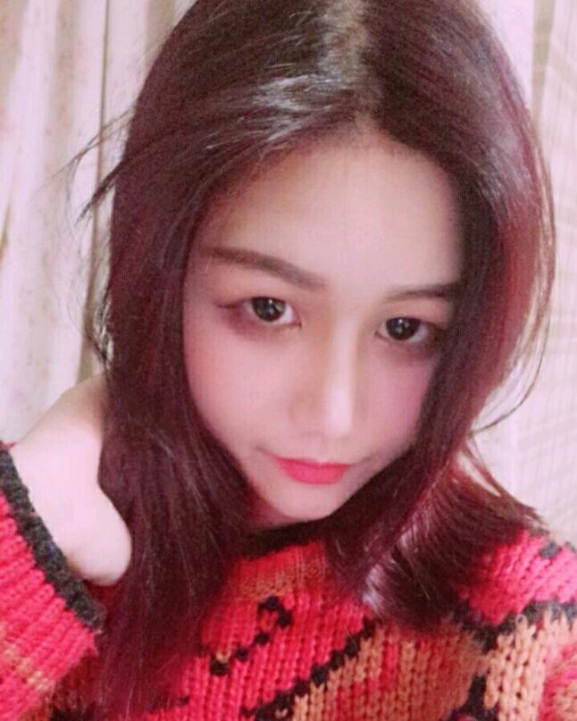成都蜀尚蓉雅美容整形医院做鼻综合术后的鼻子美美的